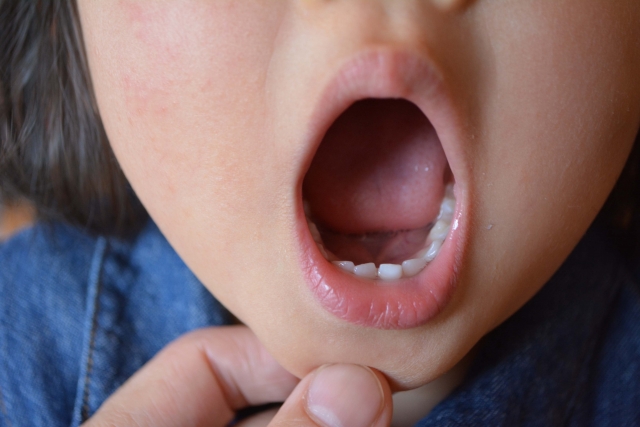 歯茎 のチェックポイント4選 歯だけでなく子供の歯茎の病気も予防しよう なごみ小児歯科クリニック