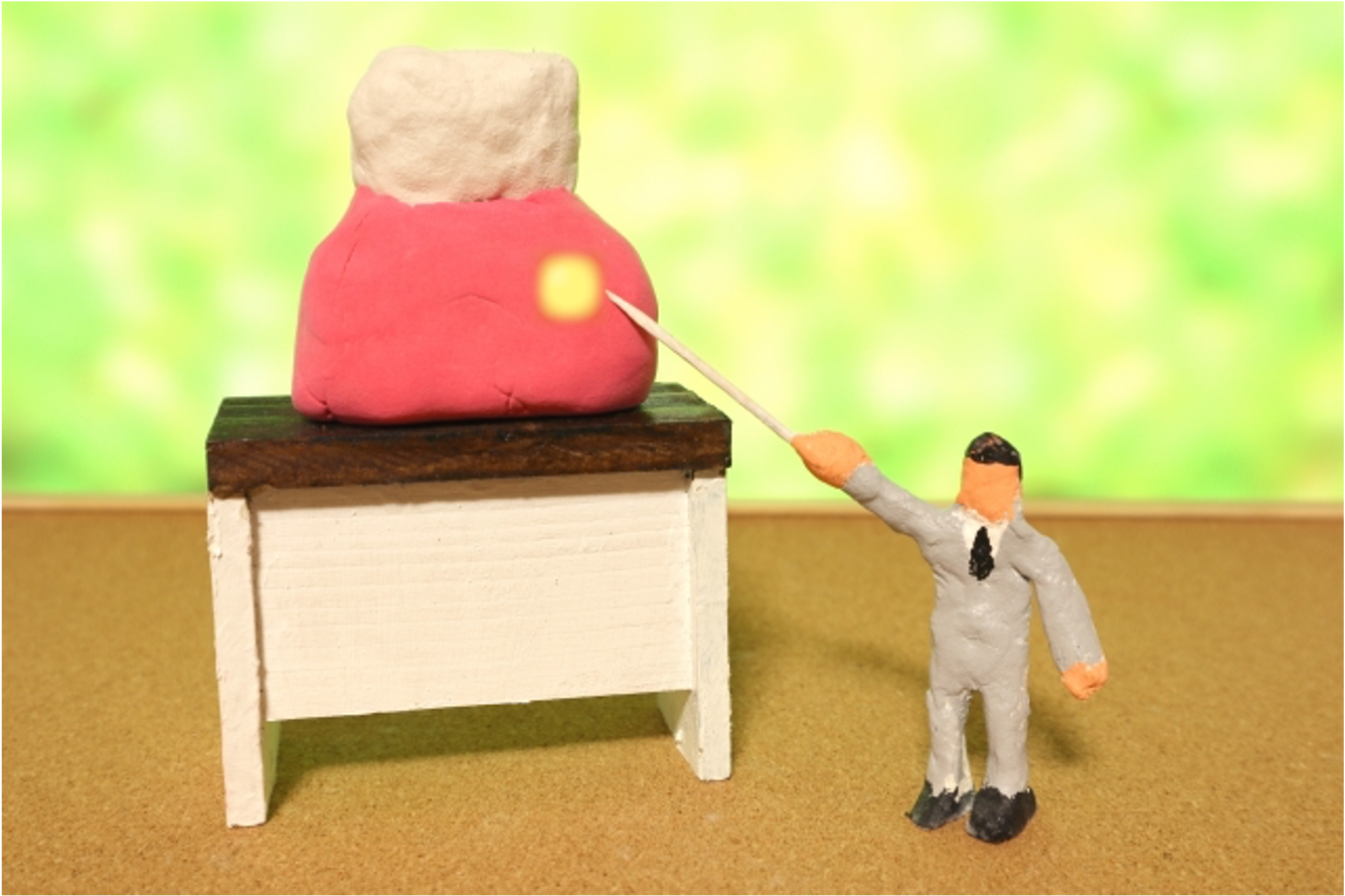 フィステル は潰すな 子供の乳歯にもできて自然治癒や市販薬では治らない なごみ小児歯科クリニック