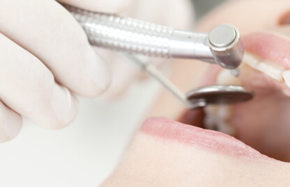 成人の方の歯科治療